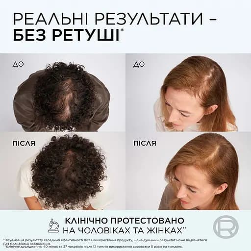 Шампунь L'Oreal Paris Elseve Growth Booster для боротьби з випадінням та ламкістю волосся 200 мл - фото 7