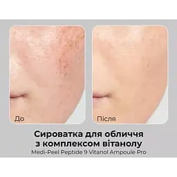 Сироватка для обличчя Medi-Peel Peptide 9 Vitanol Ampoule Pro з пептидами та комплексом вітанолу 30 мл - мініатюра 4