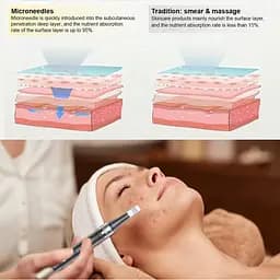Ручка для мікроголки, електрична ручка PELCAS Derma Pen Акумуляторна регульована швидкість Dermapen мікроголки - мініатюра 4