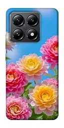 Чехол itsPrint Summer day для Xiaomi 14T