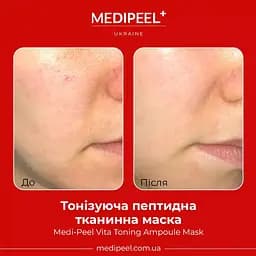 Тканинна маска для обличчя Medi-Peel Vita Toning Ampoule Mask тонізувальна ампульна 30 мл - мініатюра 3