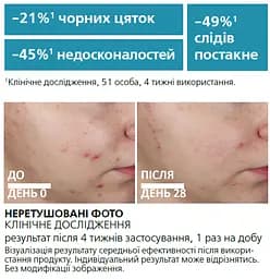 Ультраконцентрована сироватка La Roche-Posay Effaclar з ефектом пілінгу для жирної проблемної шкіри 30 мл - мініатюра 9
