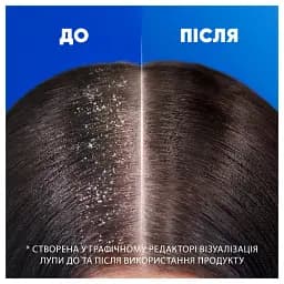 Шампунь проти лупи Head & Shoulders Основний Догляд 400 мл - мініатюра 5