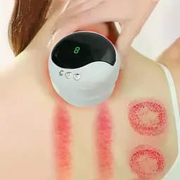 Антицелюлітний вакуумний масажер Intelligent Cupping Massage, акумуляторний ручний масажер для тіла Білий LY-873-White - мініатюра 5