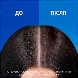 Шампунь проти лупи Head & Shoulders Проти випадіння волосся 400 мл  - мініатюра 8