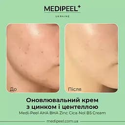 Крем для обличчя Medi Peel AHA BHA Zinc Cica-Nol B5 Cream оновлювальний з цинком і центеллою 30 мл - мініатюра 2