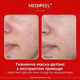 Тканинна маска-детокс Medi-Peel Rose Diamond Radiant Glow Mask зволожувальна з екстрактом троянди 25 мл - мініатюра 3