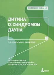 Дитина із синдромом Дауна