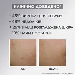 Зволожувальний крем Garnier Pure Active для надання матовості шкіри обличчя 50 мл - мініатюра 8