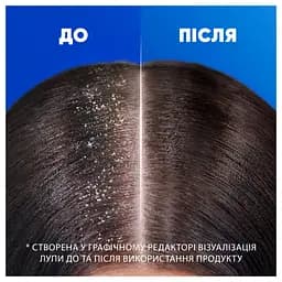 Шампунь проти лупи Head & Shoulders Яблучна свіжість 800 мл - мініатюра 7