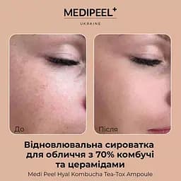 Сироватка для обличчя Medi-Peel Hyal Kombucha Tea-Tox Ampoule відновлювальна з 70% комбучі 50 мл - мініатюра 4