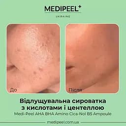 Сироватка для обличчя Medi-Peel AHA BHA Amino Cica-Nol B5 Ampoule відлущувальна 30 мл - мініатюра 4