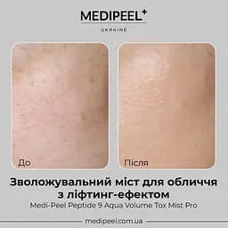 Міст для обличчя  Medi-Peel Peptide 9 Aqua Volume Tox Mist Pro зволожувальний з ліфтинг-ефектом 50 мл - мініатюра 4