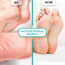 Гель-кератолітик Shelly Professional Care М'яке лезо 200 мл - мініатюра 4