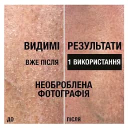 Лосьйон для тіла Neutrogena Інтенсивне відновлення 250 мл - мініатюра 6