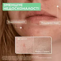 Сироватка Mixa для проблемної чутливої шкіри обличчя 30 мл - мініатюра 4