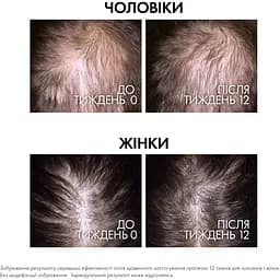 Сироватка Vichy Dercos Aminexil Clinical Regen Booster для відновлення густоти та боротьби з випадінням волосся 90 мл - мініатюра 4