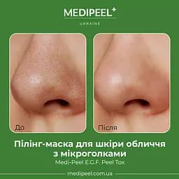 Пілінг-маска для шкіри обличчя  Medi-Peel E.G.F. Peel Tox з мікроголками 70 г - мініатюра 2