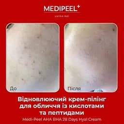 Крем-пілінг для обличчя  Medi-Peel AHA BHA 28 Days Hyal Cream відновлювальний з кислотами та пептидами 30 мл - мініатюра 4