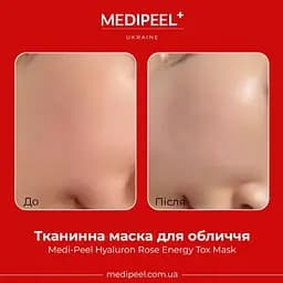 Тканинна маска для обличчя Medi-Peel Hyaluron Rose Energy Tox Mask 30 мл - мініатюра 2