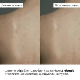Ензимна очищувальна пудра Hillary Enzyme Balance Cleanser Powder для жирної та комбінованої шкіри 40 г - мініатюра 10