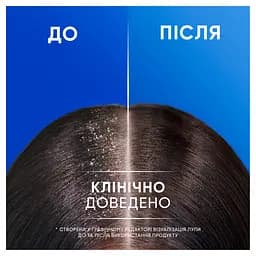 Шампунь проти лупи Head & Shoulders Основний догляд 2-в-1 400 мл - мініатюра 5