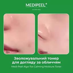 Тонер для обличчя  Medi-Peel Algo-Tox Calming Moisture Toner зволожувальний 250 мл - мініатюра 4