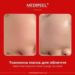 Тканинна маска-детокс Medi-Peel Hyaluron Rose Energy Tox Ampoule Mask з екстрактом троянди 30 мл - мініатюра 2