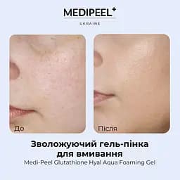 Гель-пінка для вмивання Medi-Peel Glutathione Hyal Aqua Foaming Gel Cleanser зволожувальний 150 мл - мініатюра 5