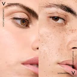 Тонік для обличчя потрійної дії Vichy Normaderm 200 мл - мініатюра 10