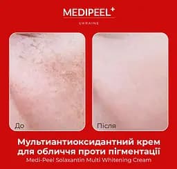 Крем для обличчя Medi-Peel Solaxantin Multi Whitening Cream мультиантиоксидантний проти пігментації 50 г - мініатюра 4