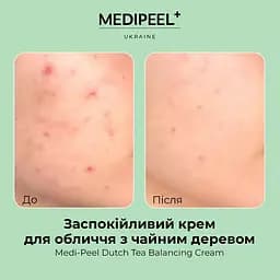 Крем для обличчя Medi-Peel Dutch Tea Balancing Cream заспокійливий з чайним деревом  70 мл - мініатюра 4