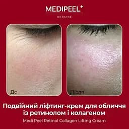 Подвійний ліфтинг-крем Medi-Peel Retinol Collagen Lifting Cream з ретинолом і колагеном 50 мл - мініатюра 4