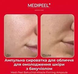 Сироватка для обличчя Medi-Peel Bakuchiol Miracle Firming Ampoule зміцнювальна з бакучиолом  30 мл - мініатюра 4