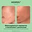Сироватка для обличчя Medi-Peel AHA BHA Amino Cica-Nol B5 Ampoule відлущувальна 30 мл - мініатюра 4