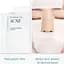 Маска для обличчя Pyunkang Yul Acne Dressing Mask Pack тканинна від акне 18 г - мініатюра 5