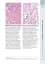 Wheater's Basic Pathology: A Text, Atlas, and Review of Histopathology. International Edition, 5th Edition - мініатюра 12