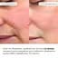 Сироватка для глибокого оновлення шкіри Deep Renew Trio Serum Hillary 30 мл - мініатюра 5