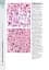 Wheater's Basic Pathology: A Text, Atlas, and Review of Histopathology. International Edition, 5th Edition - мініатюра 11