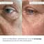 Разглаживающие патчи с био-ретинолом Hillary Bacuchiol Wrinkle Correcting & Eye Lift Patches 60 шт. - миниатюра 12