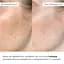 Мультисыворотка Hillary Multi Niacinamid serum с ниацинамидом и цинком 30 мл - миниатюра 10