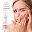 Отшелушивающий тонер для лица Re.Care Exfoliating Face Toner 150 мл - миниатюра 3