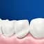 Уцінка. Електрична зубна щітка Oral-B Vitality Pro Protect X Clean чорна - мініатюра 9