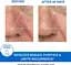Заспокійлива емульсія Uriage DS Regulating Soothing Emulsion проти себорейного дерматиту 40 мл - мініатюра 7